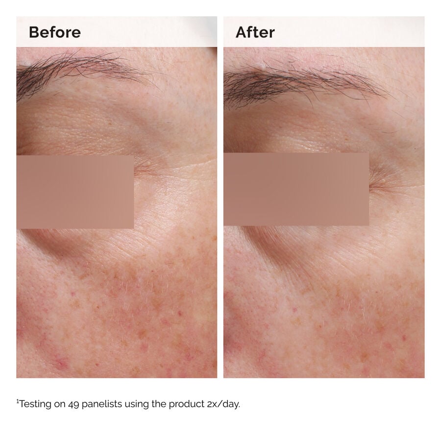 niacinamide-5-face-and-body-emulsion-p1 2024-08-23-ORD-Nia-5pct-Face-Body-B-A-Elasticity-Global-02-1x1.jpg