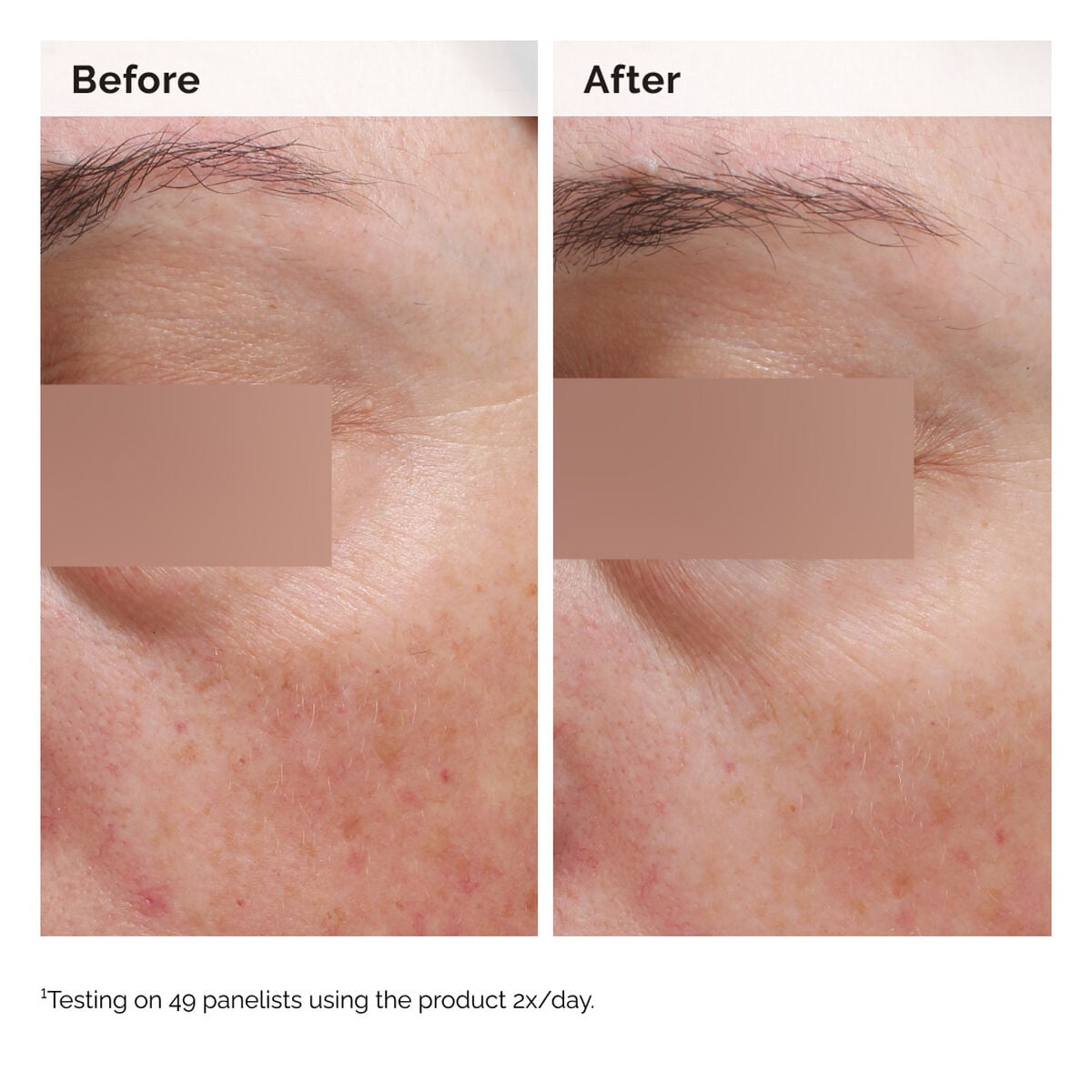 niacinamide-5-face-and-body-emulsion-p1 2024-08-23-ORD-Nia-5pct-Face-Body-B-A-Elasticity-Global-02-1x1.jpg