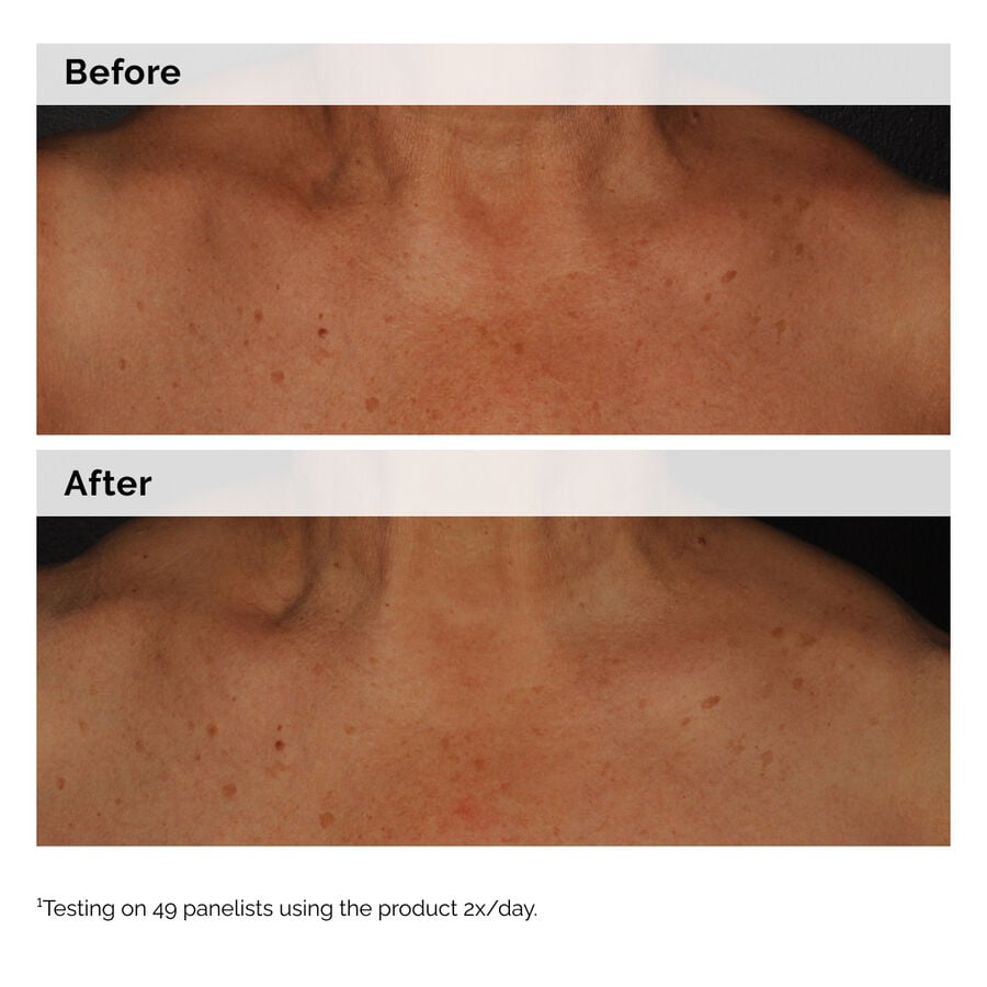 niacinamide-5-face-and-body-emulsion-p1 2024-08-23-ORD-Nia-5pct-Face-Body-B-A-Global-02-1x1.jpg
