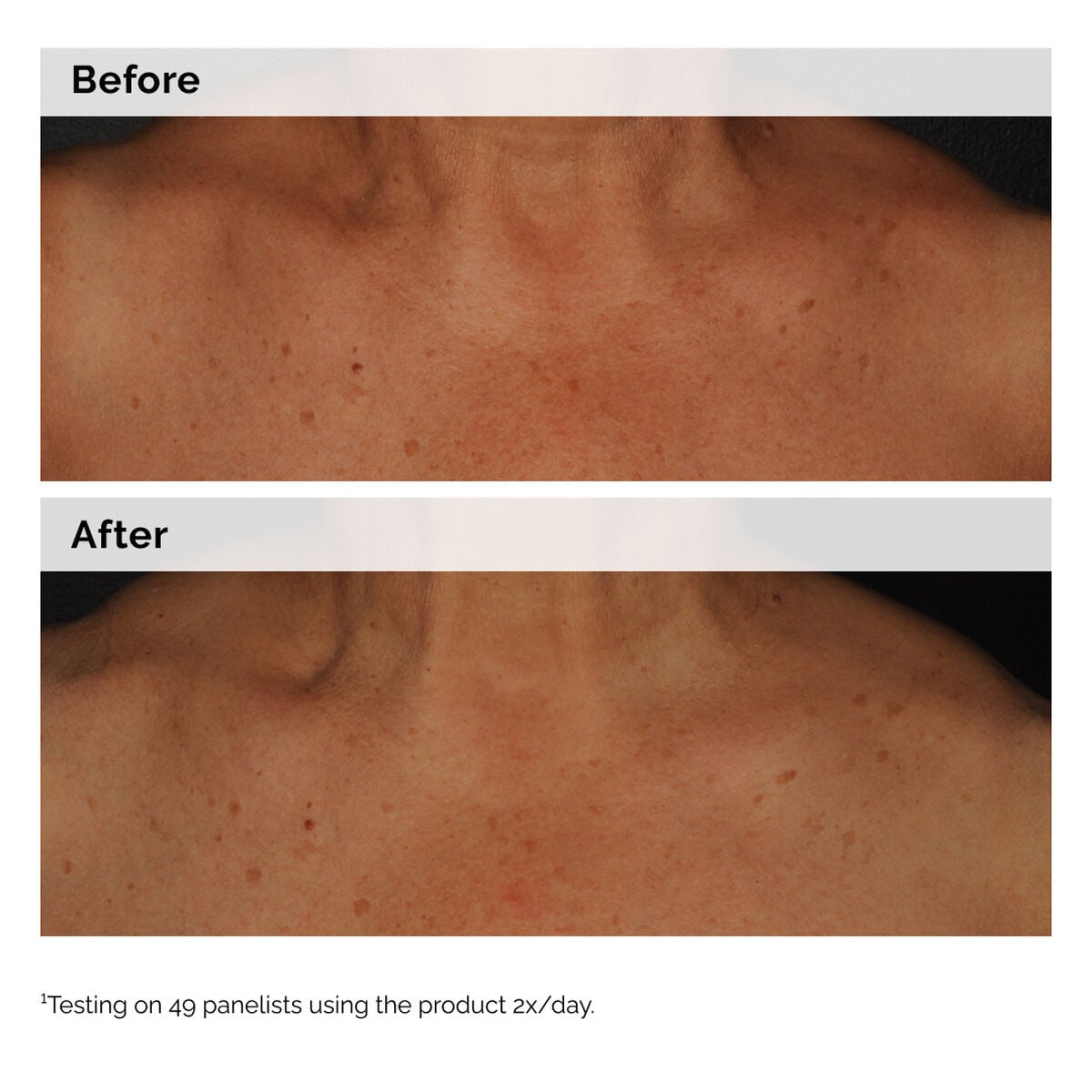 niacinamide-5-face-and-body-emulsion-p1 2024-08-23-ORD-Nia-5pct-Face-Body-B-A-Global-02-1x1.jpg