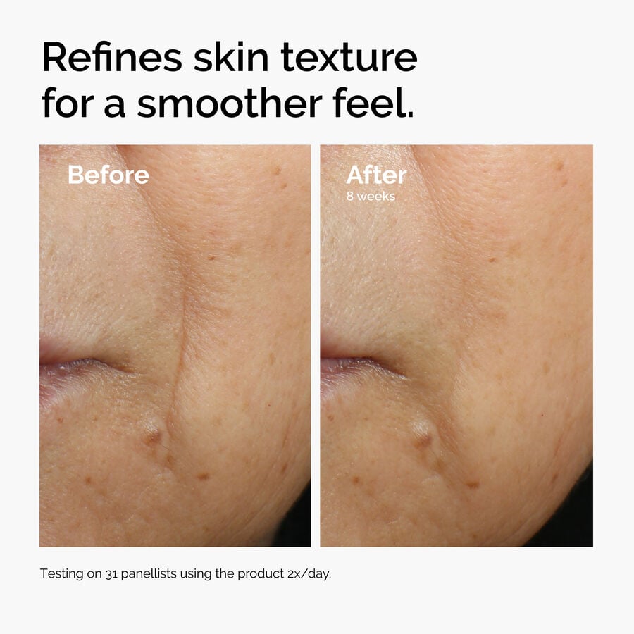 caffeine-3-escin-1-face-serum-n2 ord-caffeine-3pct-escin-1pct-face-serum-before-after-texture.jpg