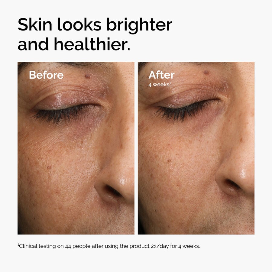 multi-antioxidant-radiance-serum-w1 ord-mars-before-after-healthy.jpg