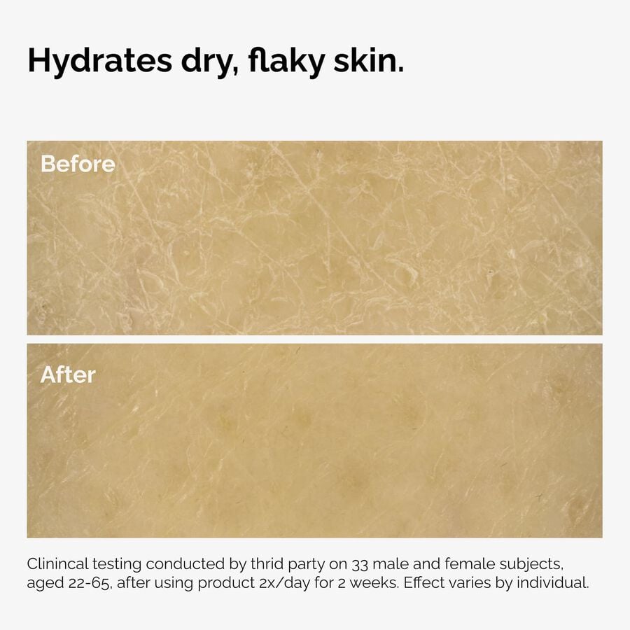 the-body-care-collection-q6 ord-natural-moisturizing-factors-inulin-body-before-after-graphic-02.jpg