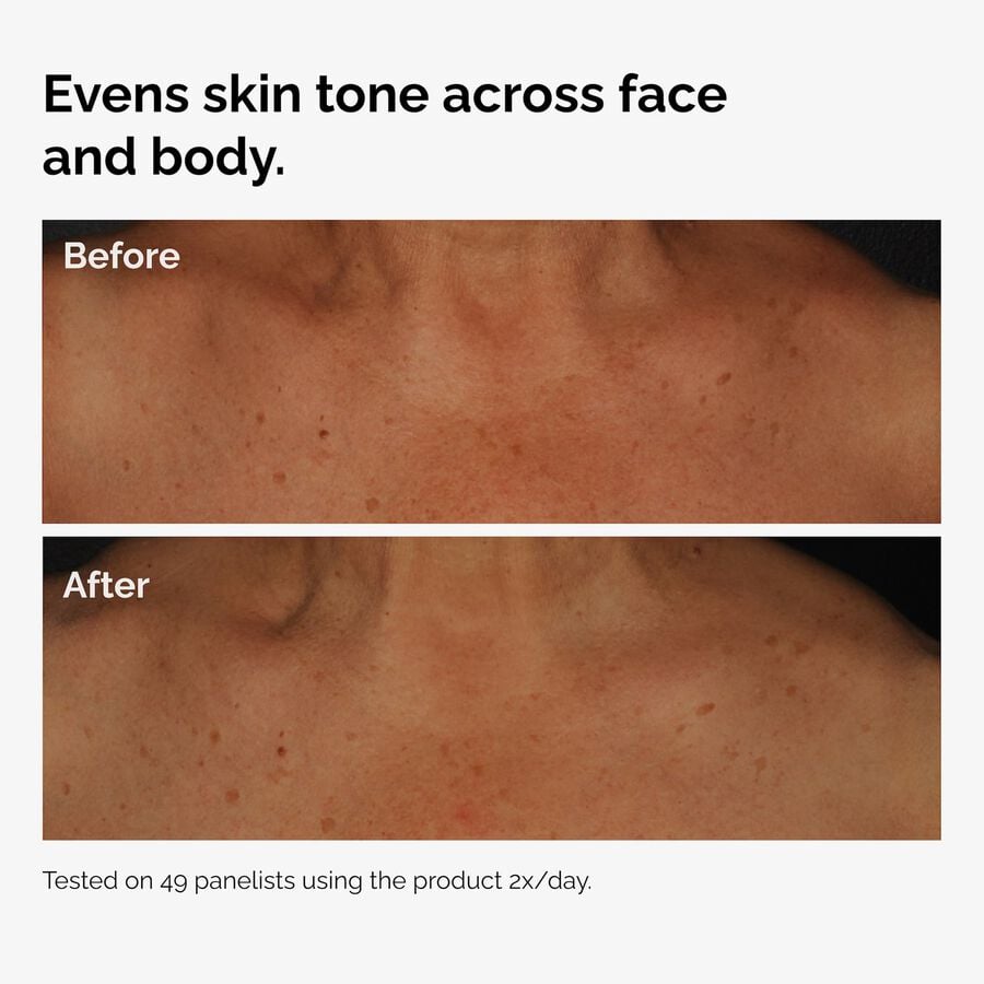 the-body-care-collection-q6 ord-niacinamide-face-body-serum-before-after-even-tone-graphic.jpg