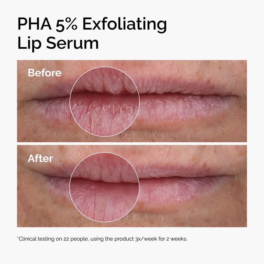pha-5-exfoliating-lip-serum-f2 ord-pha-5pct-lip-exfoliating-serum-before-after.jpg